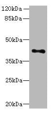 Western blot  | All lanes: HTR1E antibody at 3.3µg/ml + Hela whole cell lysate  | Secondary  | Goat polyclonal to rabbit IgG at 1/10000 dilution  | Predicted band size: 42 kDa  | Observed band size: 42 kDaRabbit anti-Human HTR1E Polyclonal Antibody