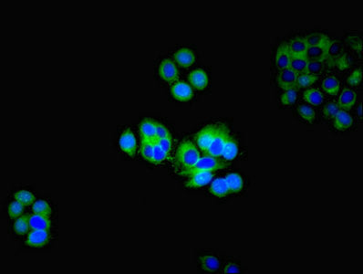 Immunofluorescent analysis of PC-3 cells using HTR2A Antibody at dilution of 1:100 and Alexa Fluor 488-congugated AffiniPure Goat Anti-Rabbit IgG(H+L)Rabbit anti-Human HTR2A Polyclonal Antibody