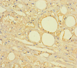Immunohistochemistry of paraffin-embedded human skin tissue using HTR2A Antibody at dilution of 1:100Rabbit anti-Human HTR2A Polyclonal Antibody