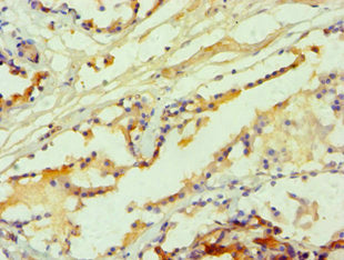 Immunohistochemistry of paraffin-embedded human prostate tissue using the antibody at dilution of 1:100Rabbit anti-Human HTR2B Polyclonal Antibody