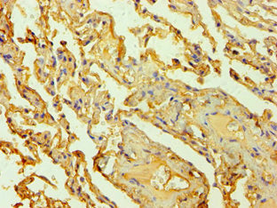 Immunohistochemistry of paraffin-embedded human lung tissue using HTR2B Antibody at dilution of 1:100Rabbit anti-Human HTR2B Polyclonal Antibody