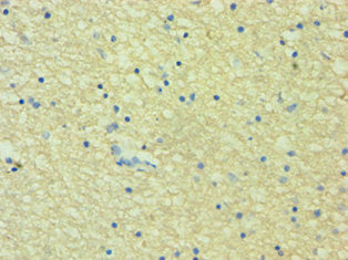 Immunohistochemistry of paraffin-embedded human brain tissue using HTR2B Antibody at dilution of 1:100Rabbit anti-Human HTR2B Polyclonal Antibody