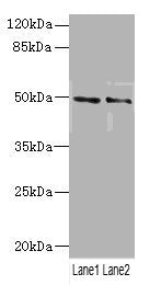 Western blot | All lanes: HTR3Bantibody at 3.29μg/ml | Lane 1: Mouse lung tissue | Lane 2: 293T whole cell lysate | Secondary | Goat polyclonal to rabbit IgG at 1/10000 dilution | Predicted band size: 51, 50 kDa | Observed band size: 51 kDaRabbit anti-Human HTR3B Polyclonal Antibody