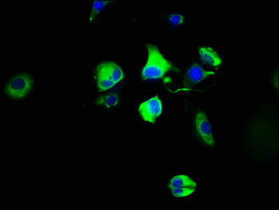 Immunofluorescence staining of MCF-7 cells with HTR4 Antibody at 1:100, counter-stained with DAPI. The cells were fixed in 4% formaldehyde, permeabilized using 0.2% Triton X-100 and blocked in 10% normal Goat Serum. The cells were then incubated with the antibody overnight at 4°C. The secondary antibody was Alexa Fluor 488-congugated AffiniPure Goat Anti-Rabbit IgG(H+L).Rabbit anti-Human HTR4 Polyclonal Antibody