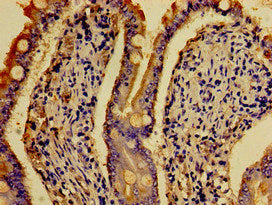 Immunohistochemistry of paraffin-embedded human small intestine tissue using the antibody at dilution of 1:100Rabbit anti-Human HTR4 Polyclonal Antibody