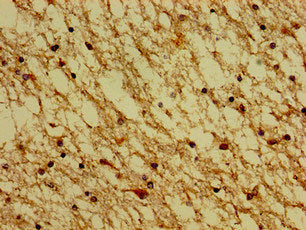 Immunohistochemistry of paraffin-embedded human brain tissue using HTR4 Antibody at dilution of 1:100Rabbit anti-Human HTR4 Polyclonal Antibody