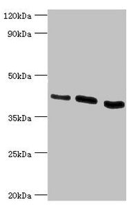 Western blot  | All lanes: HTRA2 antibody at 0.9µg/ml  | Lane 1: Hela whole cell lysate  | Lane 2: U937 whole cell lysate  | Lane 3: 293T whole cell lysate  | Secondary  | Goat polyclonal to rabbit IgG at 1/10000 dilution  | Predicted band size: 49, 39, 47, 40 kDa  | Observed band size: 39 kDaRabbit anti-Human HTRA2 Polyclonal Antibody