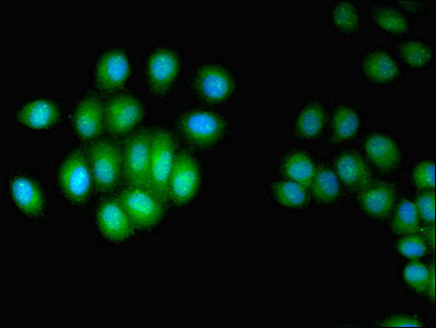 Immunofluorescent analysis of A549 cells using HUS1 Antibody at dilution of 1:100 and Alexa Fluor 488-congugated AffiniPure Goat Anti-Rabbit IgG(H+L)Rabbit anti-Human HUS1 Polyclonal Antibody