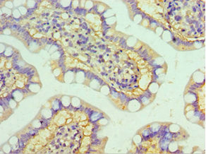 Immunohistochemistry of paraffin-embedded human small intestine tissue using HYAL3 Antibody at dilution of 1:100Rabbit anti-Human HYAL3 Polyclonal Antibody