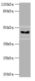 Western blot | All lanes: HYAL3 antibody at 4μg/ml + Mouse liver tissue | Secondary | Goat polyclonal to rabbit IgG at 1/10000 dilution | Predicted band size: 47, 44, 19, 16 kDa | Observed band size: 47 kDaRabbit anti-Human HYAL3 Polyclonal Antibody
