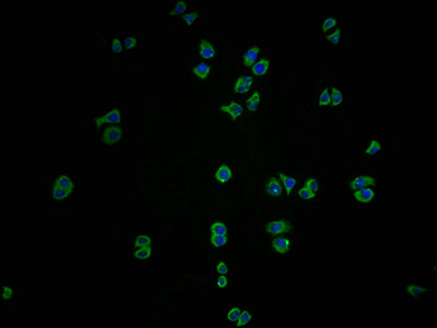 Immunofluorescence staining of PC3 cells with ICAM3 Antibody at 1:100, counter-stained with DAPI. The cells were fixed in 4% formaldehyde and blocked in 10% normal Goat Serum. The cells were then incubated with the antibody overnight at 4°C. The secondary antibody was Alexa Fluor 488-congugated AffiniPure Goat Anti-Rabbit IgG(H+L).Rabbit anti-Human ICAM3 Polyclonal Antibody