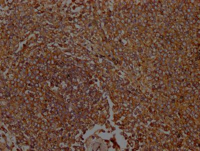 IHC image of ICAM3 Antibody diluted at 1:100 and staining in paraffin-embedded Human spleen tissue performed on a Leica BondTM system. After dewaxing and hydration, antigen retrieval was mediated by high pressure in a citrate buffer (pH 6.0). Section was blocked with 10% normal goat serum 30min at RT. Then primary antibody (1% BSA) was incubated at 4°C overnight. The primary is detected by a Goat anti-rabbit polymer IgG labeled by HRP and visualized using 0.05% DAB.Rabbit anti-Human ICAM3 Polyclonal Antibody