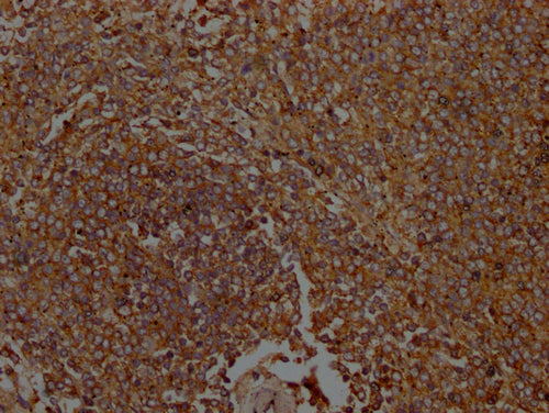 IHC image of ICAM3 Antibody diluted at 1:100 and staining in paraffin-embedded Human spleen tissue performed on a Leica BondTM system. After dewaxing and hydration, antigen retrieval was mediated by high pressure in a citrate buffer (pH 6.0). Section was blocked with 10% normal goat serum 30min at RT. Then primary antibody (1% BSA) was incubated at 4°C overnight. The primary is detected by a Goat anti-rabbit polymer IgG labeled by HRP and visualized using 0.05% DAB.Rabbit anti-Human ICAM3 Polyclonal Antibody
