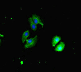Immunofluorescent analysis of A549 cells using CHD4 Antibody at dilution of 1:100 and Alexa Fluor 488-congugated AffiniPure Goat Anti-Rabbit IgG(H+L)Rabbit anti-Human CHD4 Polyclonal Antibody