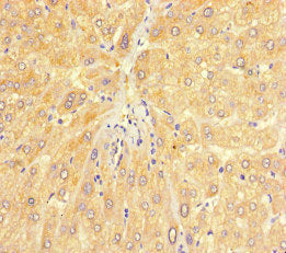 Immunohistochemistry of paraffin-embedded human liver tissue using the antibody at dilution of 1:100Rabbit anti-Human CHD4 Polyclonal Antibody