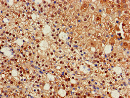 Immunohistochemistry of paraffin-embedded human adrenal gland tissue using IDH1 Antibody at dilution of 1:100Rabbit anti-Human IDH1 Polyclonal Antibody