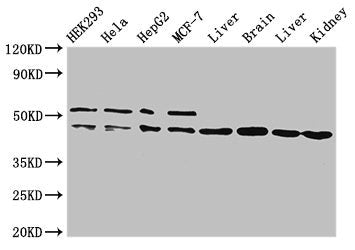 Western Blot | Positive WB detected in: HEK293 whole cell lysate, Hela whole cell lysate, HepG2 whole cell lysate, MCF-7 whole cell lysate, Rat liver tissue, Mouse brain tissue, Mouse liver tissue, Mouse kidney tissue | All lanes: IDH1 antibody at 2μg/ml | Secondary | Goat polyclonal to rabbit IgG at 1/50000 dilution | Predicted band size: 47 kDa | Observed band size: 47, 52 kDaRabbit anti-Human IDH1 Polyclonal Antibody