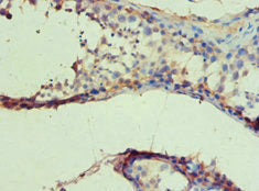 Immunohistochemistry of paraffin-embedded human testis tissue using IDH1 Antibody at dilution of 1:100Rabbit anti-Human IDH1 Polyclonal Antibody
