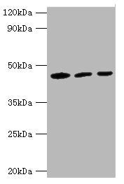 Western blot  | All lanes: IDH1 antibody at 3µg/ml  | Lane 1: Mouse liver tissue  | Lane 2: Hela whole cell lysate  | Lane 3: NIH/3T3 whloe cell lysate  | Secondary  | Goat polyclonal to rabbit at 1/10000 dilution  | Predicted band size: 47 kDa  | Observed band size: 47 kDaRabbit anti-Human IDH1 Polyclonal Antibody