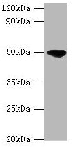 Western blot  | All lanes: IDH2 antibody at 5µg/ml + Hela whole cell lysate  | Secondary  | Goat polyclonal to rabbit IgG at 1/10000 dilution  | Predicted band size: 51, 46 kDa  | Observed band size: 51 kDaRabbit anti-Human IDH2 Polyclonal Antibody
