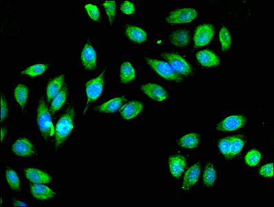 Immunofluorescent analysis of A549 cells using IDH3A Antibody at dilution of 1:100 and Alexa Fluor 488-congugated AffiniPure Goat Anti-Rabbit IgG(H+L)Rabbit anti-Human IDH3A Polyclonal Antibody