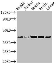 Western Blot  | Positive WB detected in: HepG2 whole cell lysat, Jurkat whole cell lysate, Rat brain tissue, Mouse brain tissue, Mouse liver tissue  | All lanes: IDH3A antibody at 3.4µg/ml  | Secondary  | Goat polyclonal to rabbit IgG at 1/50000 dilution  | Predicted band size: 40, 32 kDa  | Observed band size: 40 kDaRabbit anti-Human IDH3A Polyclonal Antibody