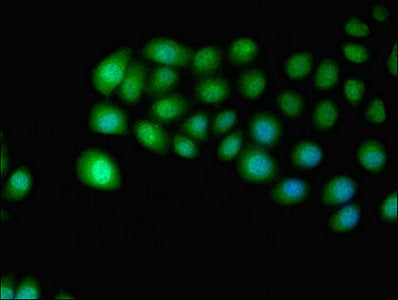 Immunofluorescent analysis of A549 cells using IDO2 Antibody at dilution of 1:100 and Alexa Fluor 488-congugated AffiniPure Goat Anti-Rabbit IgG(H+L)Rabbit anti-Human IDO2 Polyclonal Antibody