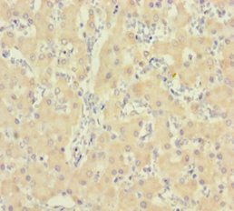 Immunohistochemistry of paraffin-embedded human liver tissue using the antibody at dilution of 1:100Rabbit anti-Human IDO2 Polyclonal Antibody