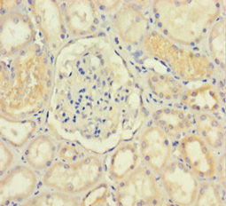 Immunohistochemistry of paraffin-embedded human kidney tissue using IDO2 Antibody at dilution of 1:100Rabbit anti-Human IDO2 Polyclonal Antibody