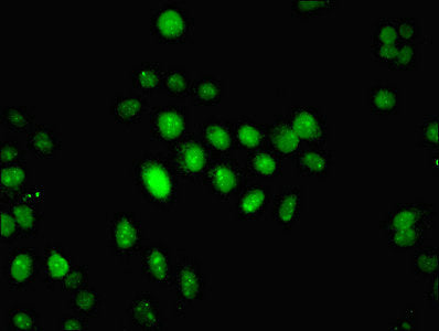 Immunofluorescent analysis of HepG2 cells using IFI44 Antibody at dilution of 1:100 and Alexa Fluor 488-congugated AffiniPure Goat Anti-Rabbit IgG(H+L)Rabbit anti-Human IFI44 Polyclonal Antibody