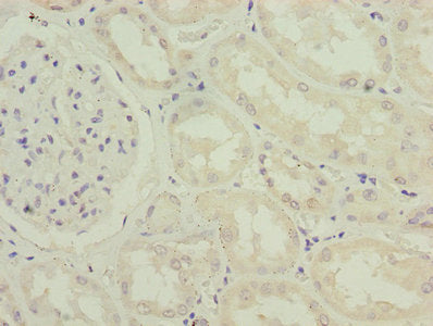 Immunohistochemistry of paraffin-embedded human kidney tissue using IFI44 Antibody at dilution of 1:100Rabbit anti-Human IFI44 Polyclonal Antibody