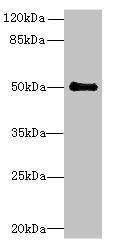 Western blot  | All lanes: IFI44 antibody at 6µg/ml + Mouse lung tissue  | Secondary  | Goat polyclonal to rabbit IgG at 1/10000 dilution  | Predicted band size: 51, 15 kDa  | Observed band size: 51 kDaRabbit anti-Human IFI44 Polyclonal Antibody