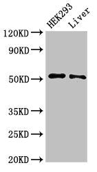 Western Blot  | Positive WB detected in: HEK293 whole cell lysate, Rat liver tissue  | All lanes: IFIT2 antibody at 3µg/ml  | Secondary  | Goat polyclonal to rabbit IgG at 1/50000 dilution  | Predicted band size: 55 kDa  | Observed band size: 55 kDaRabbit anti-Human IFIT2 Polyclonal Antibody