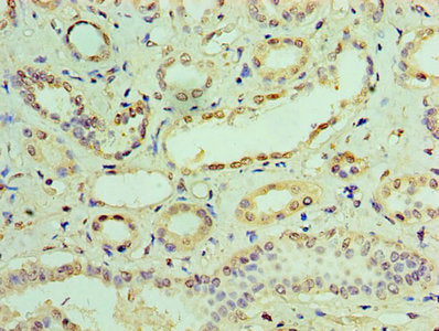 Immunohistochemistry of paraffin-embedded human kidney tissue using IFIT3 Antibody at dilution of 1:100Rabbit anti-Human IFIT3 Polyclonal Antibody