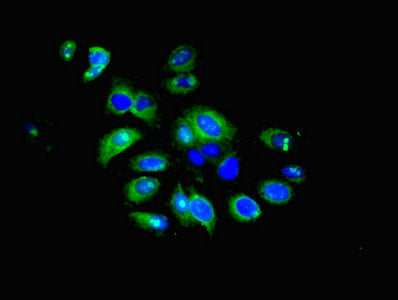 Immunofluorescent analysis of HepG2 cells using IFIT5 Antibody at dilution of 1:100 and Alexa Fluor 488-congugated AffiniPure Goat Anti-Rabbit IgG(H+L)Rabbit anti-Human IFIT5 Polyclonal Antibody