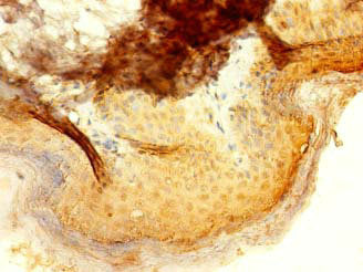 Immunohistochemistry of paraffin-embedded human skin tissue using IFIT5 Antibody at dilution of 1:100Rabbit anti-Human IFIT5 Polyclonal Antibody