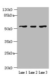 Western blot  | All lanes: IFIT5 antibody at 2µg/ml  | Lane 1: A375 whole cell lysate  | Lane 2: Jurkat whole cell lysate  | Lane 3: HepG2 whole cell lysate  | Secondary  | Goat polyclonal to rabbit IgG at 1/10000 dilution  | Predicted band size: 56, 51 kDa  | Observed band size: 56 kDaRabbit anti-Human IFIT5 Polyclonal Antibody