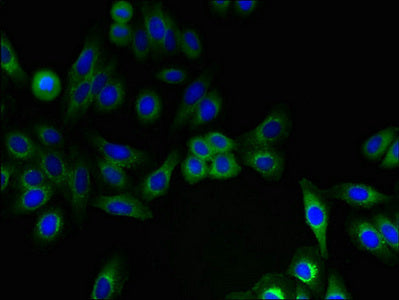 Immunofluorescent analysis of HepG2 cells using IFITM2 Antibody at dilution of 1:100 and Alexa Fluor 488-congugated AffiniPure Goat Anti-Rabbit IgG(H+L)Rabbit anti-Human IFITM2 Polyclonal Antibody