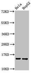 Western Blot  | Positive WB detected in: Hela whole cell lysate, HepG2 whole cell lysate  | All lanes: IFITM3 antibody at 2.5µg/ml  | Secondary  | Goat polyclonal to rabbit IgG at 1/50000 dilution  | Predicted band size: 15 kDa  | Observed band size: 15 kDaRabbit anti-Human IFITM3 Polyclonal Antibody
