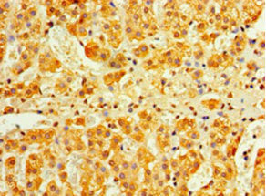 Immunohistochemistry of paraffin-embedded human adrenal gland tissue using IFNA4 Antibody at dilution of 1:100Rabbit anti-Human IFNA4 Polyclonal Antibody