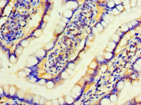 Immunohistochemistry of paraffin-embedded human small intestine tissue using IFNA4 Antibody at dilution of 1:100Rabbit anti-Human IFNA4 Polyclonal Antibody