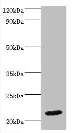 Western blot  | All lanes: IFNA4 antibody at 2µg/ml + Mouse kidney tissue  | Secondary  | Goat polyclonal to rabbit IgG at 1/10000 dilution  | Predicted band size: 22 kDa  | Observed band size: 22 kDaRabbit anti-Human IFNA4 Polyclonal Antibody