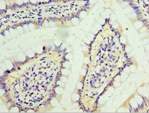 Immunohistochemistry of paraffin-embedded human small intestine tissue using IFNGR1 Antibody at dilution of 1:100Rabbit anti-Human IFNGR1 Polyclonal Antibody