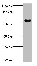Western blot | All lanes: IFNGR1 antibody at 2μg/ml + Mouse lung tissue | Secondary | Goat polyclonal to rabbit IgG at 1/10000 dilution | Predicted band size: 55, 22 kDa | Observed band size: 55 kDaRabbit anti-Human IFNGR1 Polyclonal Antibody