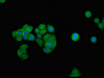 Immunofluorescence staining of PC-3 cells with IFNGR2 Antibody at 1:100, counter-stained with DAPI. The cells were fixed in 4% formaldehyde, permeabilized using 0.2% Triton X-100 and blocked in 10% normal Goat Serum. The cells were then incubated with the antibody overnight at 4°C. The secondary antibody was Alexa Fluor 488-congugated AffiniPure Goat Anti-Rabbit IgG(H+L).Rabbit anti-Human IFNGR2 Polyclonal Antibody