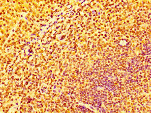 IHC image of the antibody diluted at 1:100 and staining in paraffin-embedded human tonsil tissue performed on a Leica BondTM system. After dewaxing and hydration, antigen retrieval was mediated by high pressure in a citrate buffer (pH 6.0). Section was blocked with 10% normal goat serum 30min at RT. Then primary antibody (1% BSA) was incubated at 4°C overnight. The primary is detected by a biotinylated secondary antibody and visualized using an HRP conjugated SP system.Rabbit anti-Human IFNGR2 Polyclonal Antibody