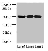 Western blot | All lanes: IFRD1 antibody at 1.76μg/ml | Lane 1: Mouse skeletal muscle tissue | Lane 2: Hela whole cell lysate | Lane 3: Jurkat whole cell lysate | Secondary | Goat polyclonal to rabbit IgG at 1/10000 dilution | Predicted band size: 51, 46 kDa | Observed band size: 51 kDaRabbit anti-Human IFRD1 Polyclonal Antibody