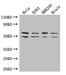 Western Blot | Positive WB detected in: Hela whole cell lysate, K562 whole cell lysate, HEK293 whole cell lysate, Mouse brain tissue | All lanes: IGF2BP3 antibody at 2μg/ml | Secondary | Goat polyclonal to rabbit IgG at 1/50000 dilution | Predicted band size: 64, 22 kDa | Observed band size: 64, 50 kDaRabbit anti-Human IGF2BP3 Polyclonal Antibody