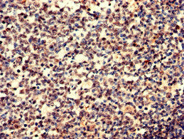 Immunohistochemistry analysis of human tonsil tissue using IGHD Antibody at dilution of 1:100