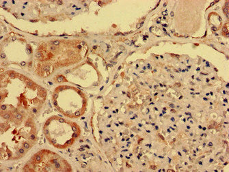 Immunohistochemistry analysis of human kidney tissue using IGHD Antibody at dilution of 1:100